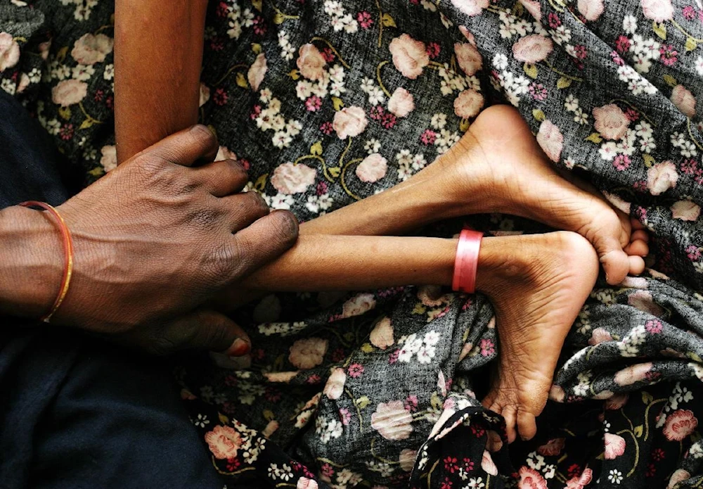Desnutrición crónica en niños aumenta en el Perú