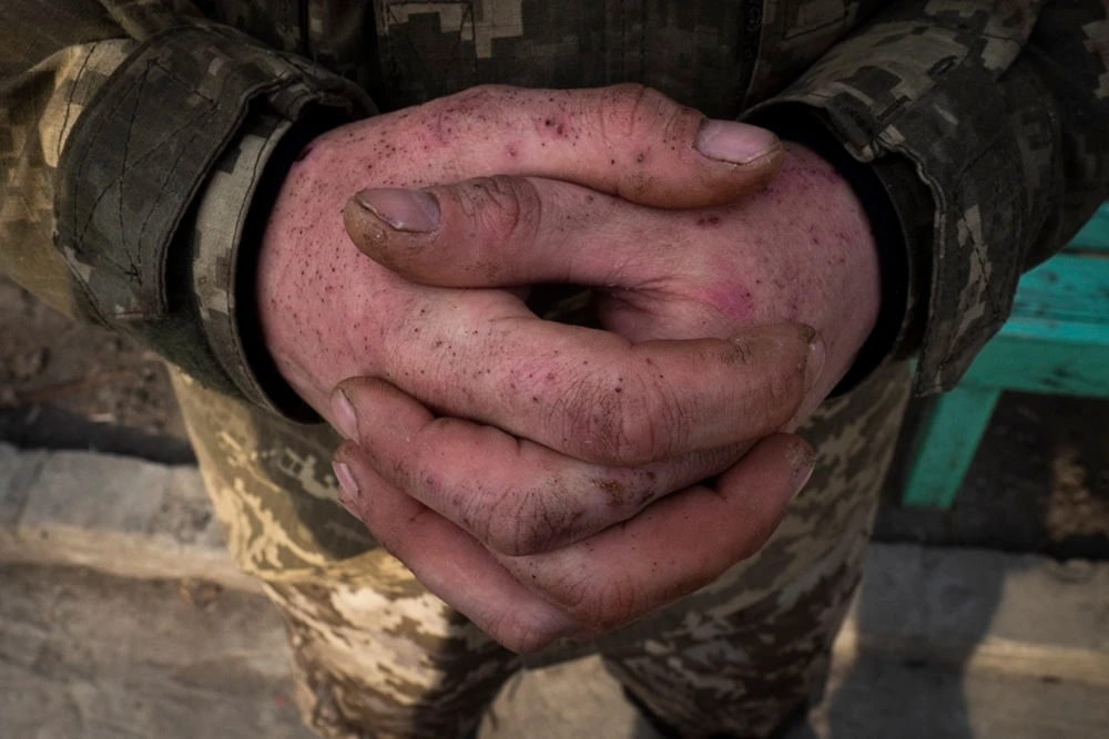 Horribles crímenes de guerra: soldados ucranianos atacan civiles rusos